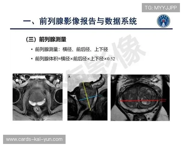 前列得分差距缩小 前列得分差距缩小